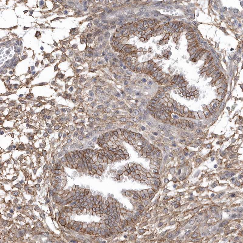 Immunohistochemistry-Paraffin CRIP3 Antibody - BSA Free