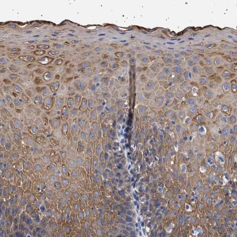 Staining of human esophagus shows moderate cytoplasmic positivity in squamous epithelial cells.