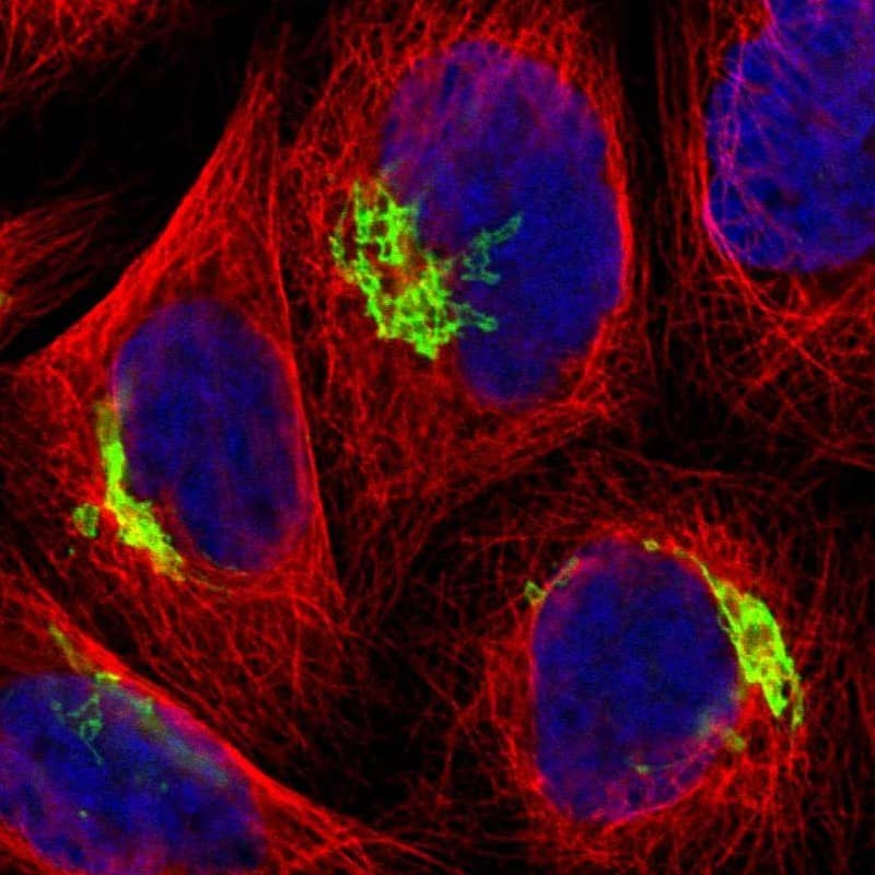 Staining of human cell line A-431 shows localization to the Golgi apparatus.