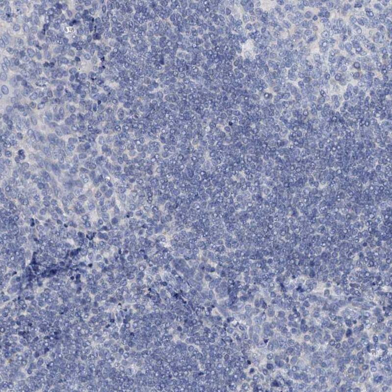 Staining of human tonsil shows no positivity in non-germinal center cells as expected.