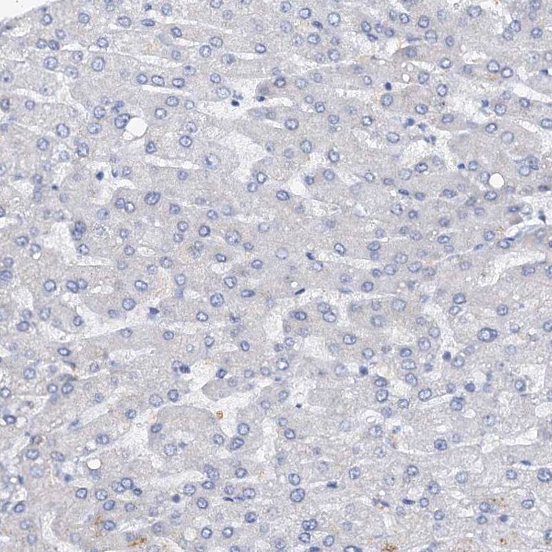 Staining of human liver shows no positivity in hepatocytes as expected.