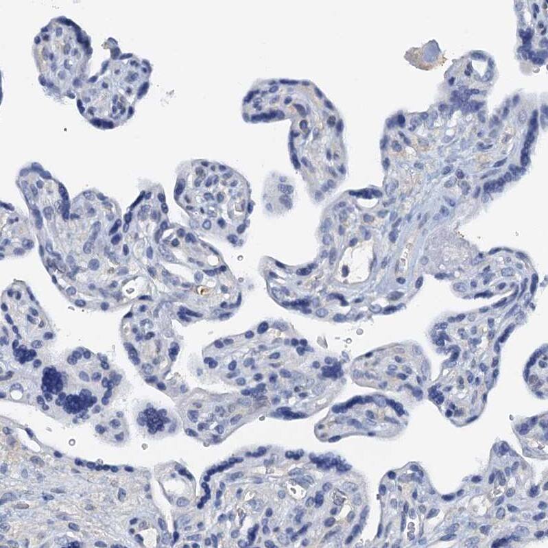 Staining of human placenta shows no positivity in trophoblastic cells as expected.
