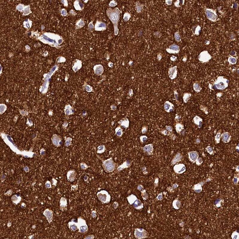 Staining of human cerebral cortex shows strong cytoplasmic positivity in neuropil.