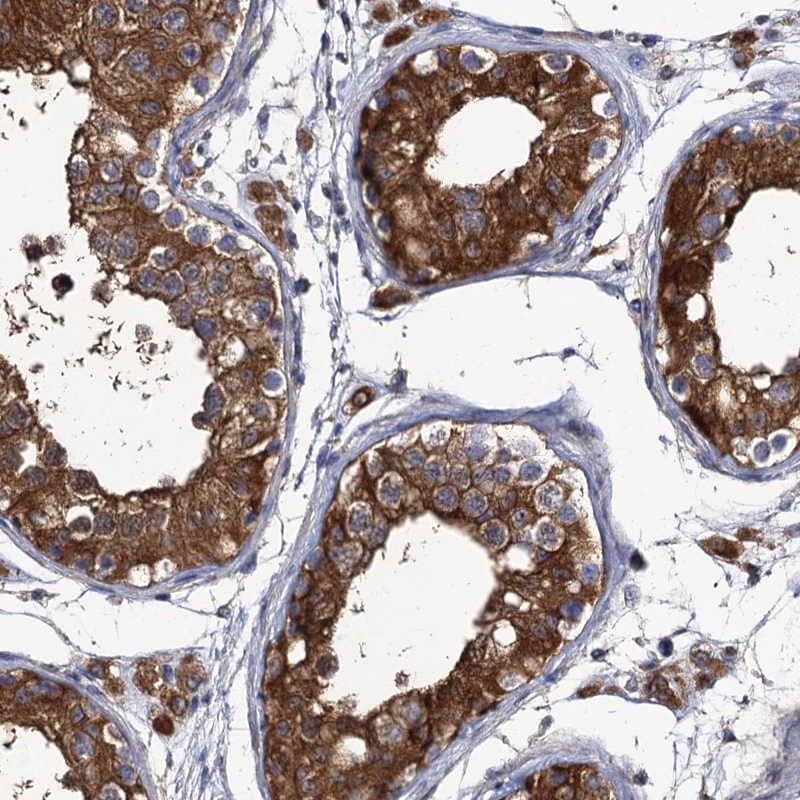 Immunohistochemistry-Paraffin DYDC1 Antibody - BSA Free