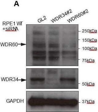 Western Blot: WDR34 Antibody [NBP1-88805] - (A) RNAi of WDR34 & WDR60 validated by immunoblotting with GAPODH as a loading control.(B) Immunofluorescence of TMEM67 & RPGRIP1L in WDR34 & WDR60 depleted cells. TMEM67 is seen at the base & within the cilium proximal to this in both control & depleted cells, RPGRIP1L is more tightly restricted to the base of the cilium in all cases. These are representative images, we have analysed multiple fields of view in each case using z-stacks & cannot identify any difference. Image collected & cropped by CiteAb from the following publication (//pubmed.ncbi.nlm.nih.gov/30320547), licensed under a CC-BY license. Not internally tested by Novus Biologicals.