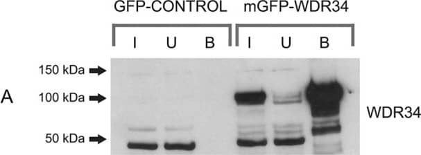 Western Blot: WDR34 Antibody [NBP1-88805] - Immunoprecipitation from serum-starved RPE1 cells stably expressing either mGFP or mGFP–WDR34. GFP-traps of cells expressing mGFP alone or mGFP–WDR34 were separated by SDS-PAGE & immunoblotted to detect (A) WDR34, (B) WDR60, (C) IC74 (DYNC1I2), (D) GAPDH, (E) p150Glued, (F) p50dynamitin, (G) LIS1, (H) Tctex-1, (I) NudCD3 or (J) TCTEX1D2, as indicated. Molecular-mass markers are shown (kDa). In each case, the lanes show the input (‘I’), the unbound fraction (‘U’) & the bound fraction (‘B’), as indicated. The asterisk in J indicates non-specific bands. Image collected & cropped by CiteAb from the following publication (//journals.biologists.com/jcs/article/doi/10.1242/jcs.159038/259056/Subunit-composition-of-the-human-cytoplasmic), licensed under a CC-BY license. Not internally tested by Novus Biologicals.