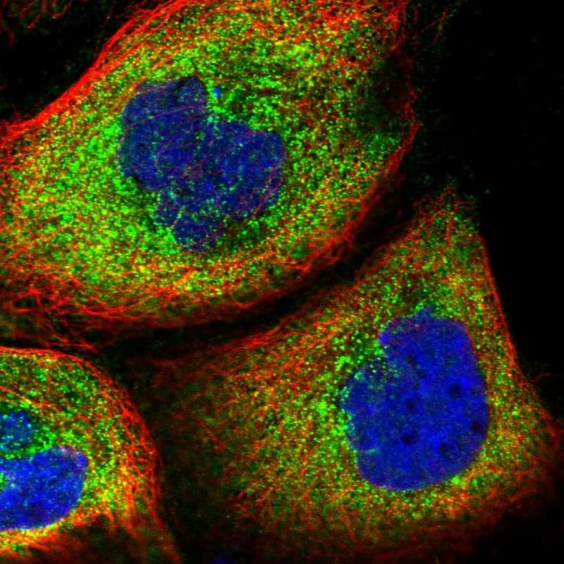 Staining of human cell line A-431 shows localization to cytosol.