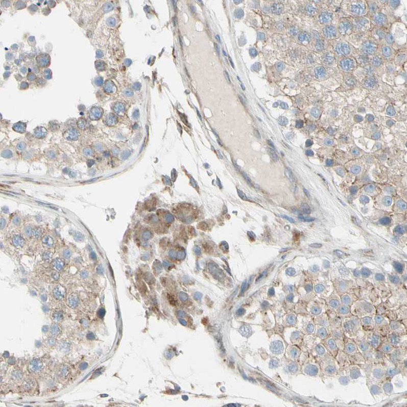 Immunohistochemistry-Paraffin FNDC3A Antibody - BSA Free