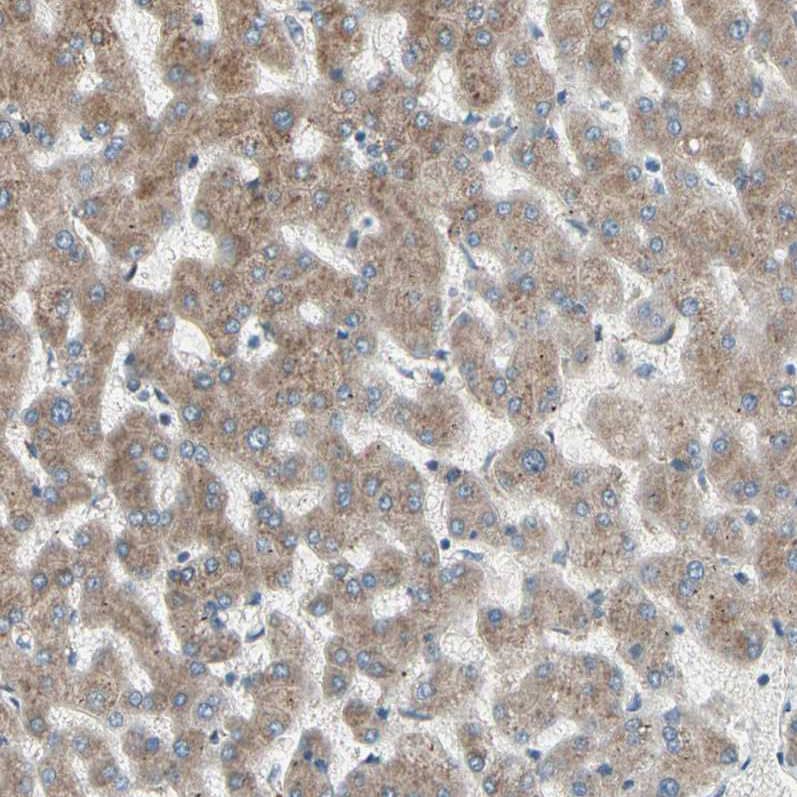 Staining of human liver shows moderate granular cytoplasmic positivity in hepatocytes.