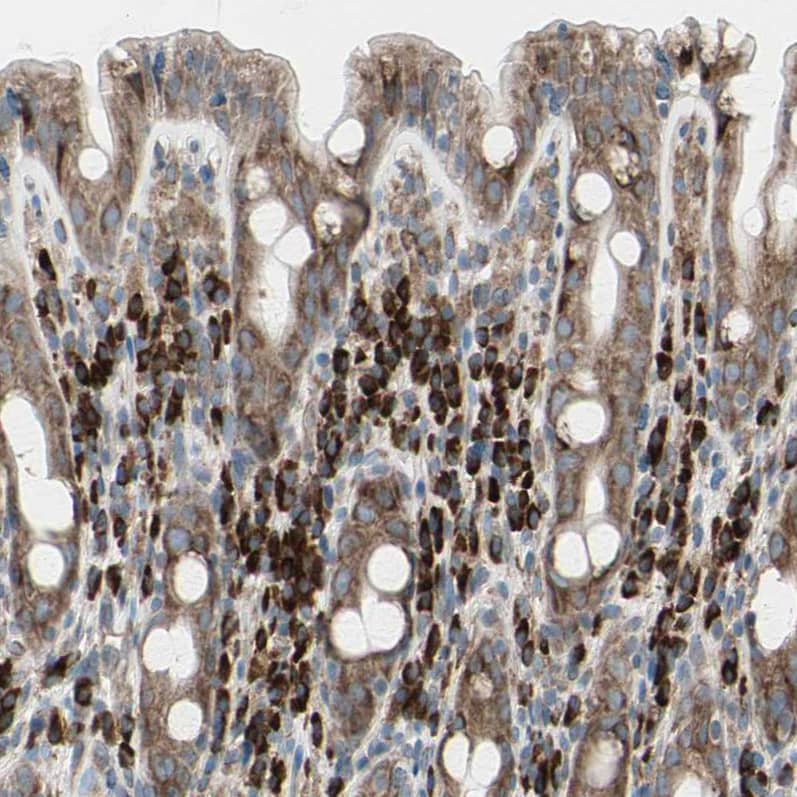 Staining of human rectum shows strong granular cytoplasmic positivity in lymphoid cells.