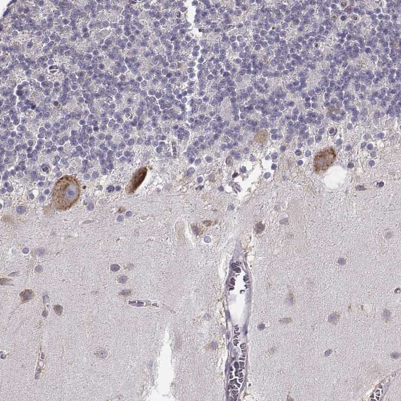 Staining of human cerebellum shows strong cytoplasmic positivity in Purkinje cells.