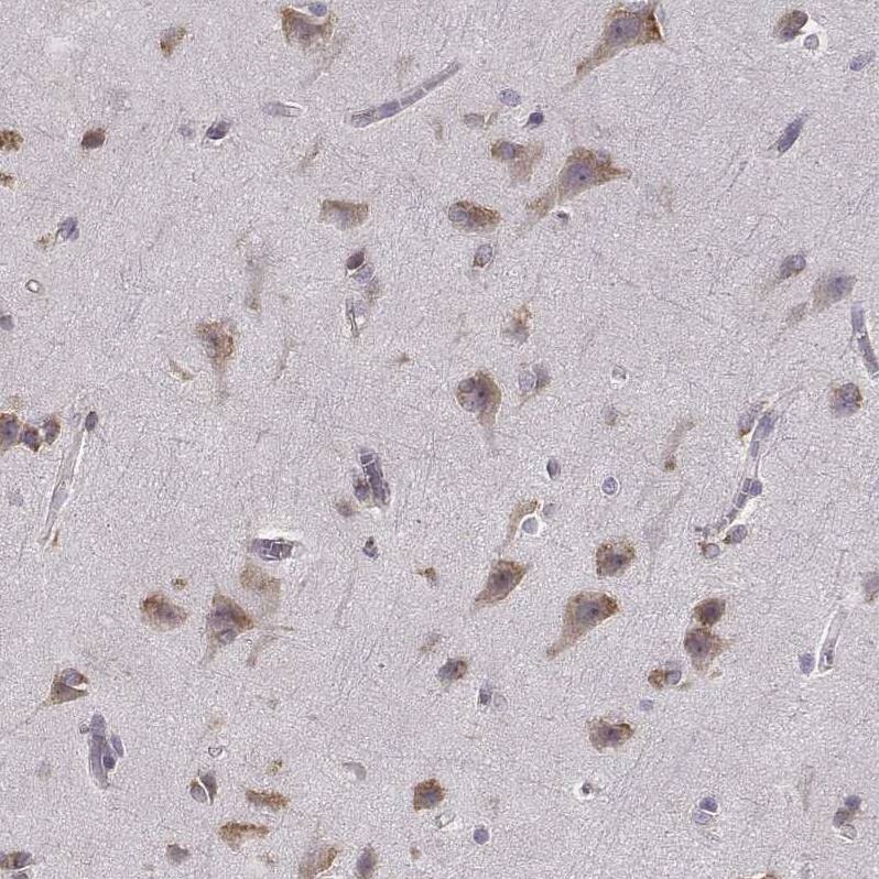 Staining of human cerebral cortex shows moderate cytoplasmic positivity in neuronal cells.