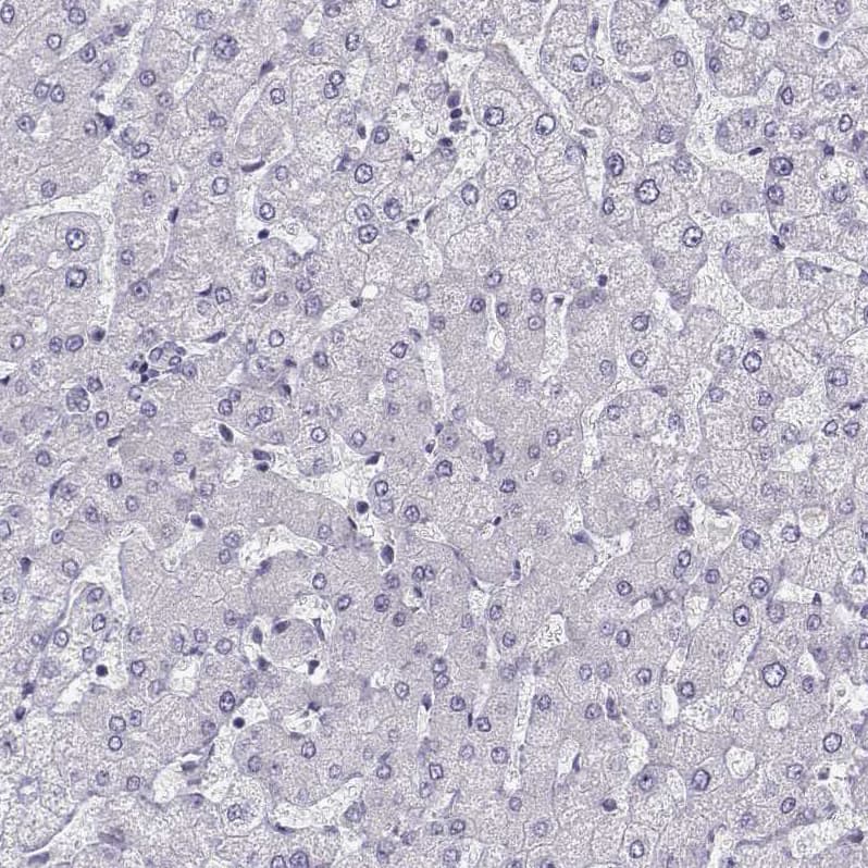 Staining of human liver shows no positivity in hepatocytes as expected.