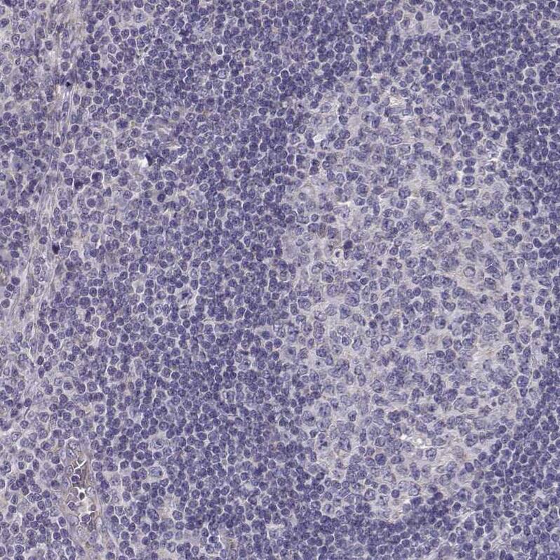 Staining of human lymph node shows no positivity in non-germinal center cells as expected.