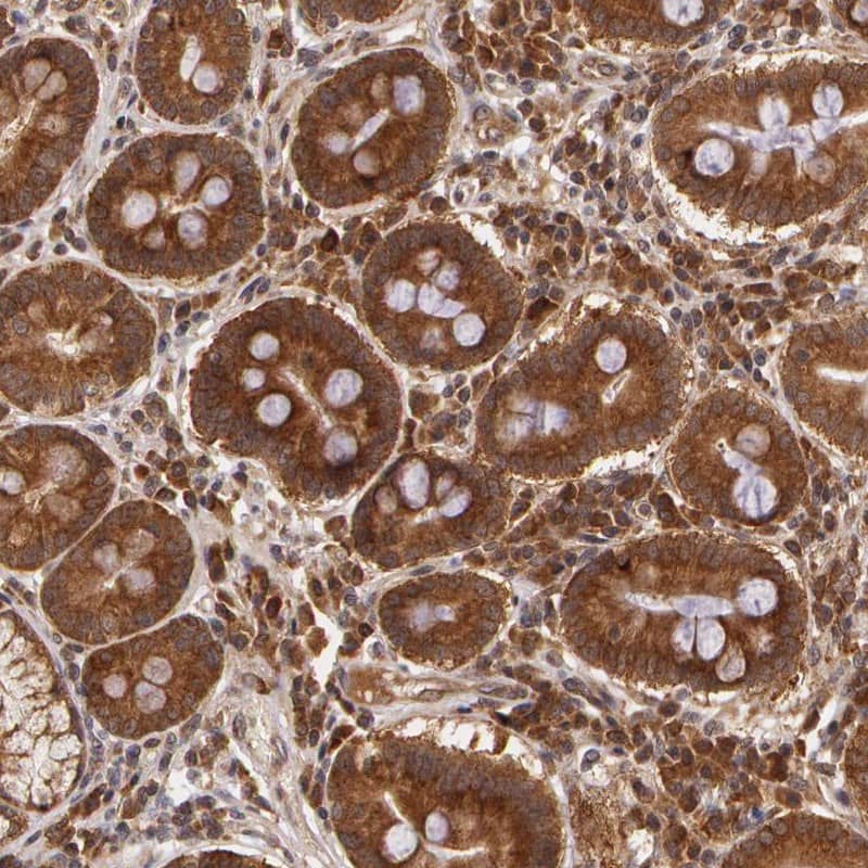 Immunohistochemistry-Paraffin ASCC2 Antibody - BSA Free