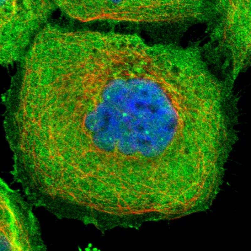 Staining of human cell line A-431 shows localization to nuclear bodies, plasma membrane & cytosol.