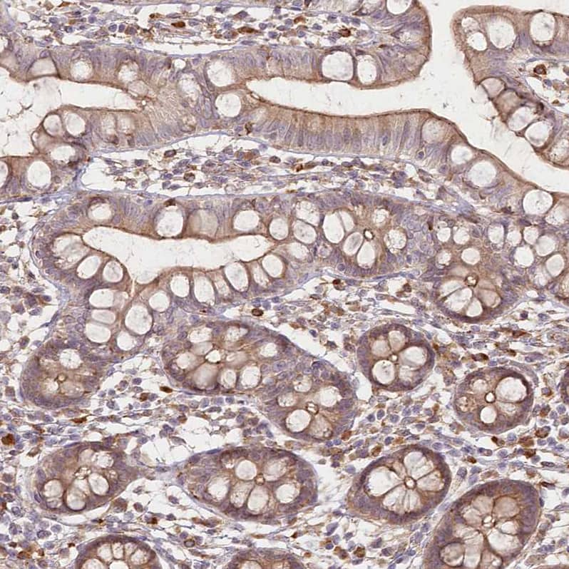 Immunohistochemistry-Paraffin FAM13A Antibody - BSA Free