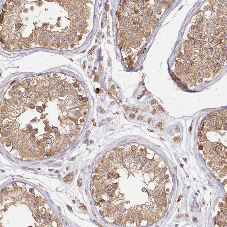 Immunohistochemistry-Paraffin FAM13A Antibody - BSA Free