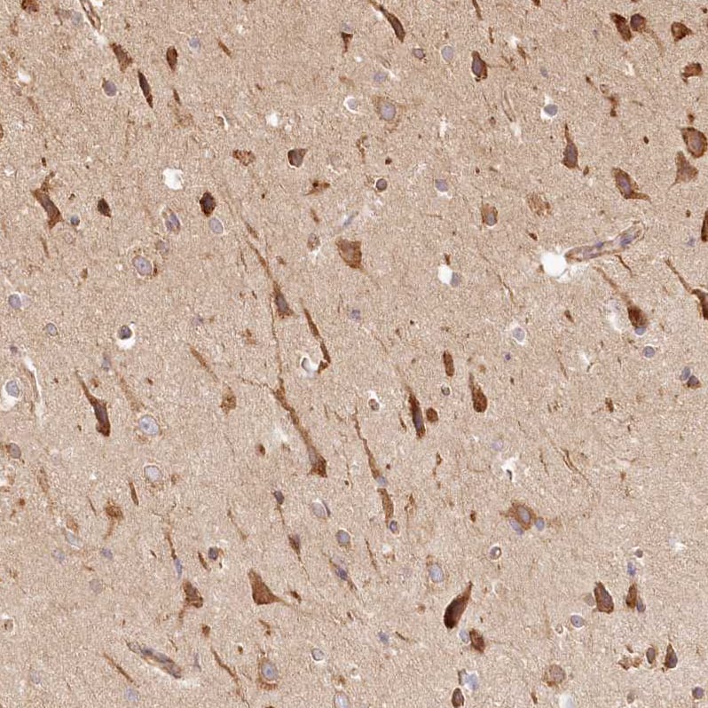 Staining of human cerebral cortex shows strong cytoplasmic positivity in neurons.