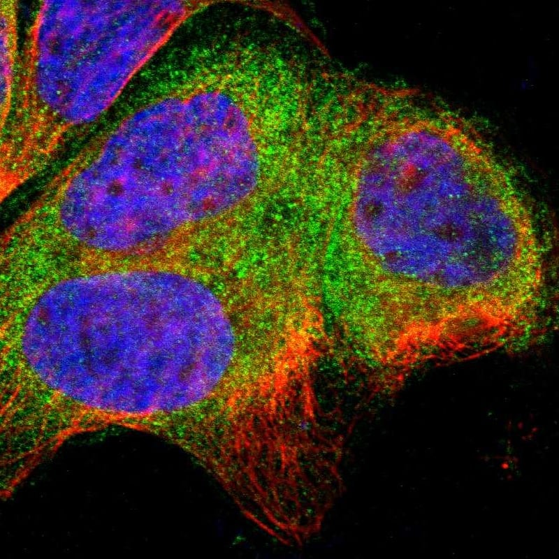 Staining of human cell line A-431 shows localization to cytosol.