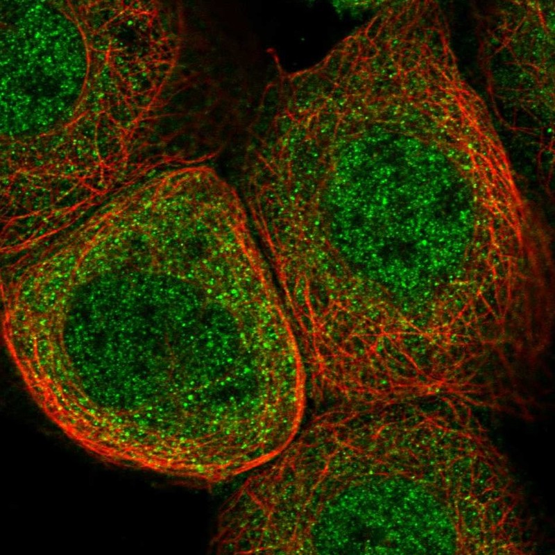 Staining of human cell line A-431 shows localization to nucleoplasm & cytosol.