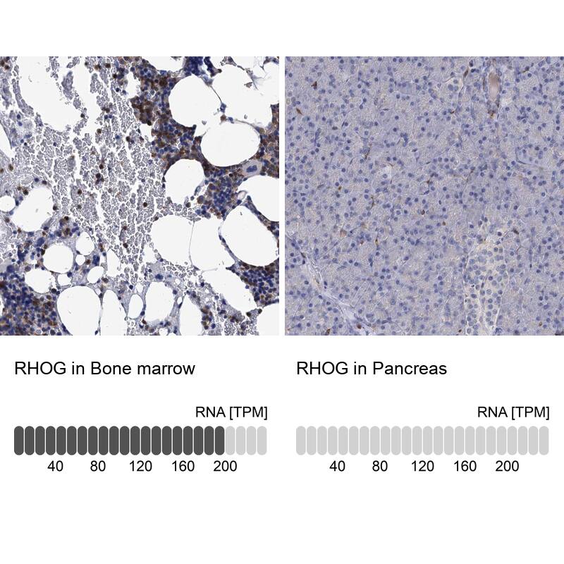 <b>Orthogonal Strategies Validation. </b>Analysis in human bone marrow and pancreas tissues.
