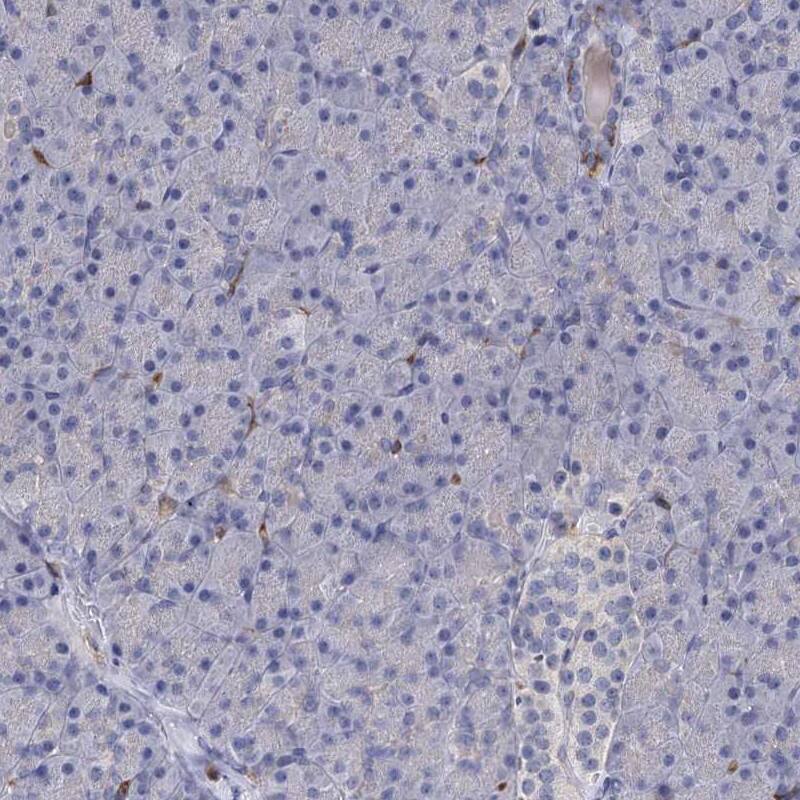 Staining of human pancreas shows low expression as expected.