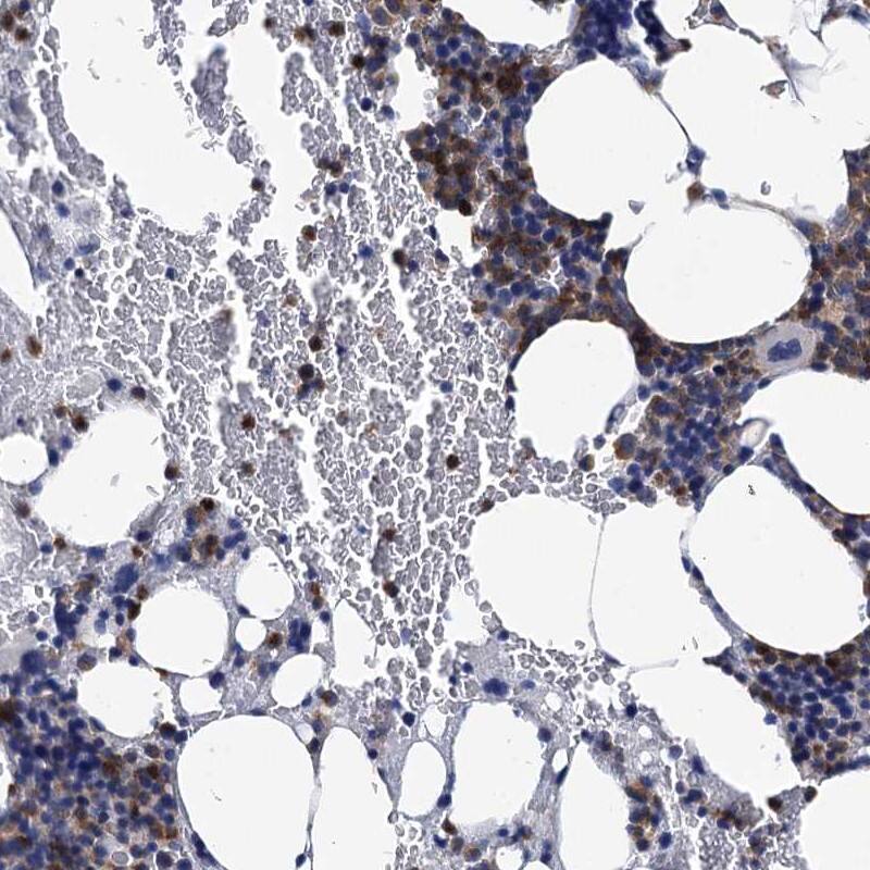 Staining of human bone marrow shows high expression.
