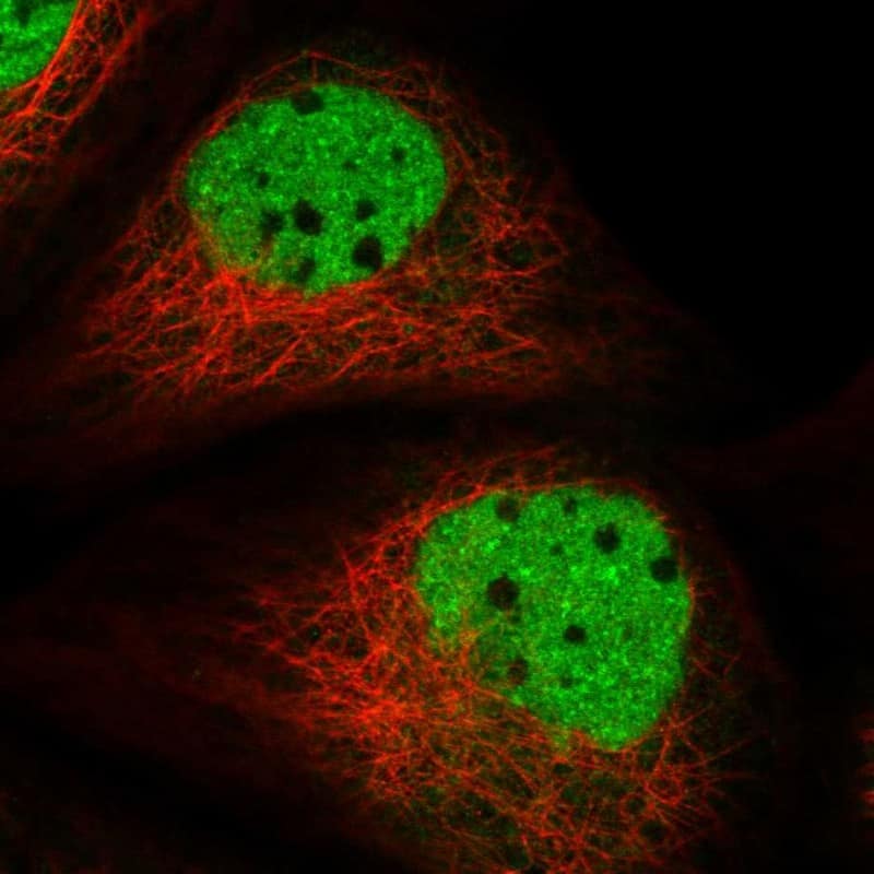 Staining of human cell line A-431 shows localization to nucleoplasm.