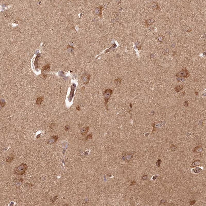 Immunohistochemistry-Paraffin ARL3 Antibody - BSA Free