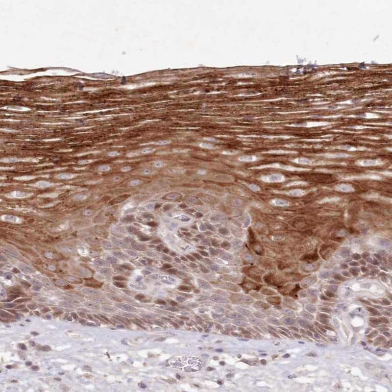 Immunohistochemistry-Paraffin ASCC1 Antibody - BSA Free