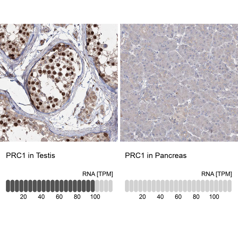 Immunohistochemistry-Paraffin PRC1 Antibody - BSA Free