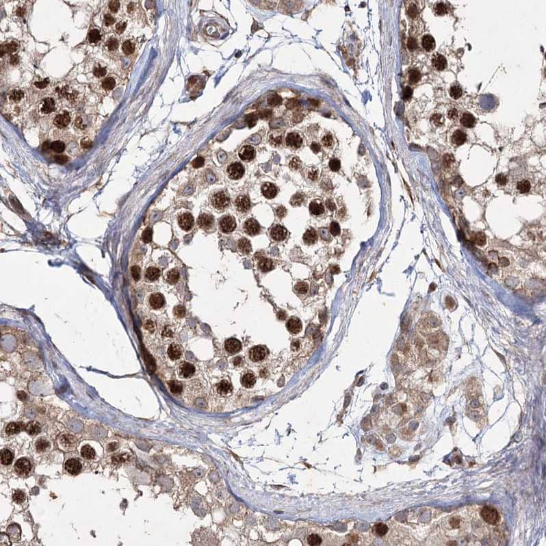 Staining of human testis shows strong nuclear positivity in cells in seminiferous ducts.
