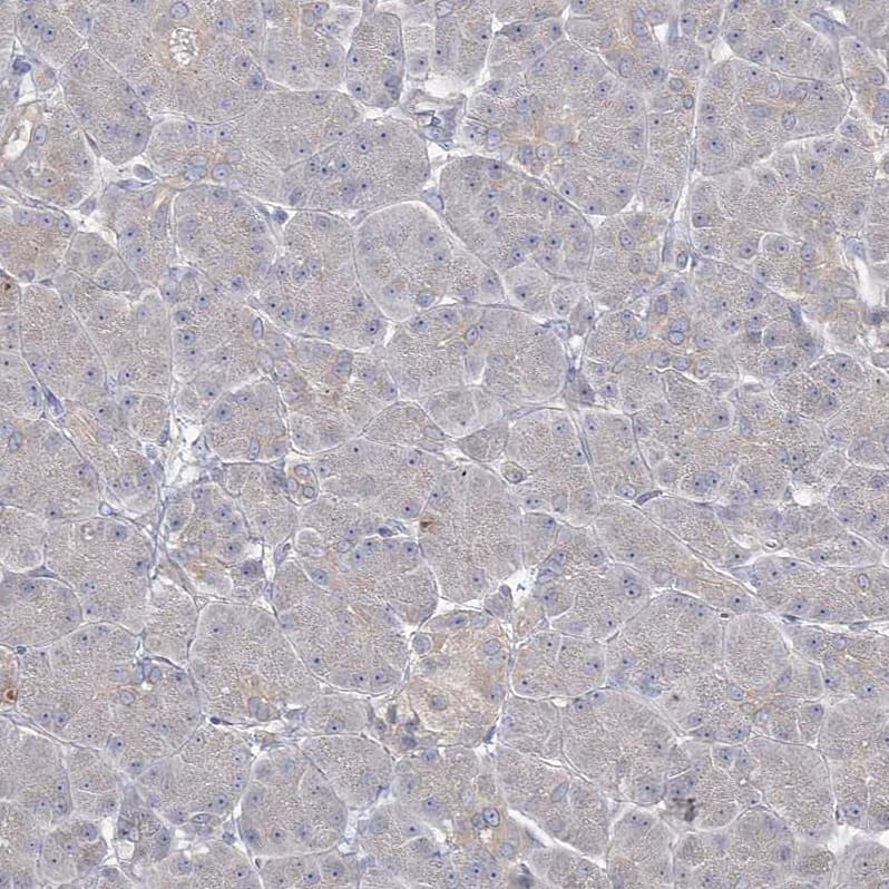 Staining of human pancreas shows no positivity in exocrine glandular cells as expected.