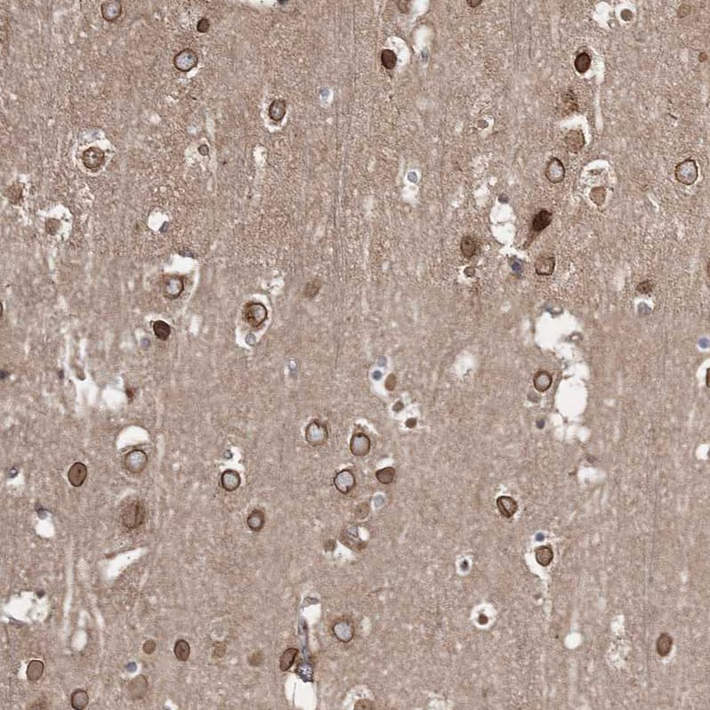 Staining of human cerebral cortex shows moderate positivity in nuclear membrane in neurons.