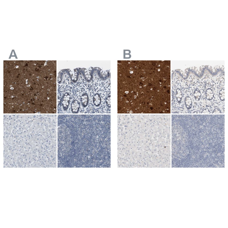 <b>Independent Antibodies Validation. </b>Staining of human cerebral cortex, colon, liver and lymph node using NBP1-88870 (A) shows similar protein distribution across tissues to independent antibody NBP1-88871 (B).