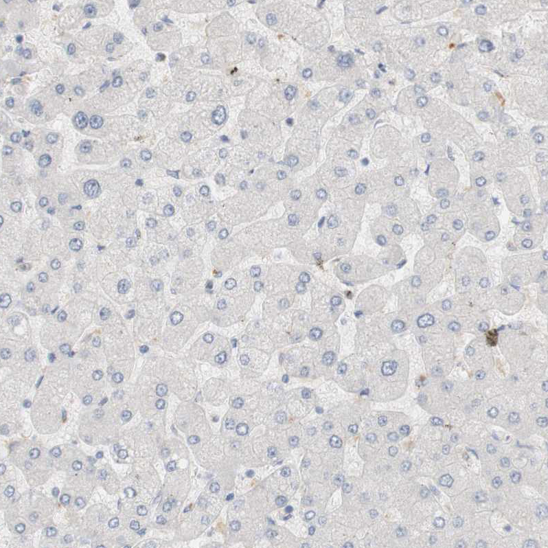 Immunohistochemistry-Paraffin RTN3 Antibody - BSA Free