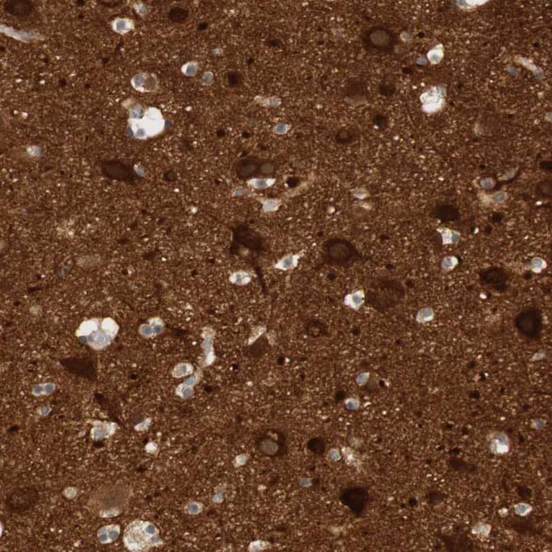Staining of human cerebral cortex shows strong cytoplasmic positivity in neurons.