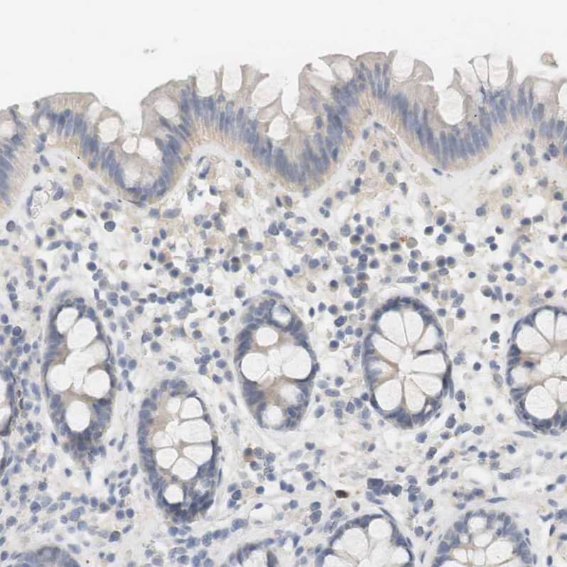 Staining of human colon shows no positivity in glandular cells as expected.