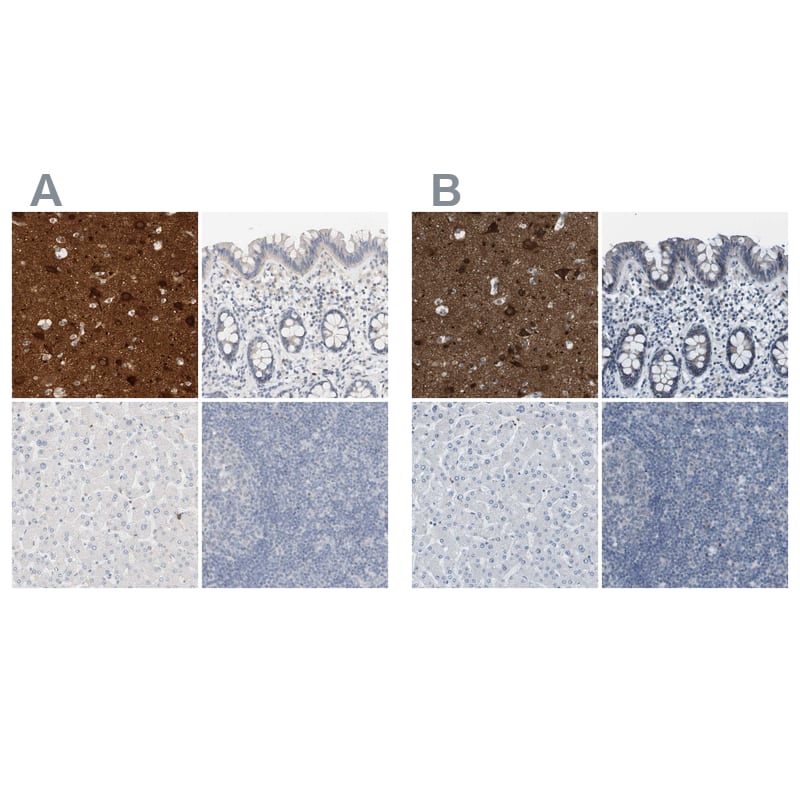 Staining of human cerebral cortex, colon, liver and lymph node HPA015650 (A) shows similar protein distribution across tissues to independent antibody HPA015649 (B).
