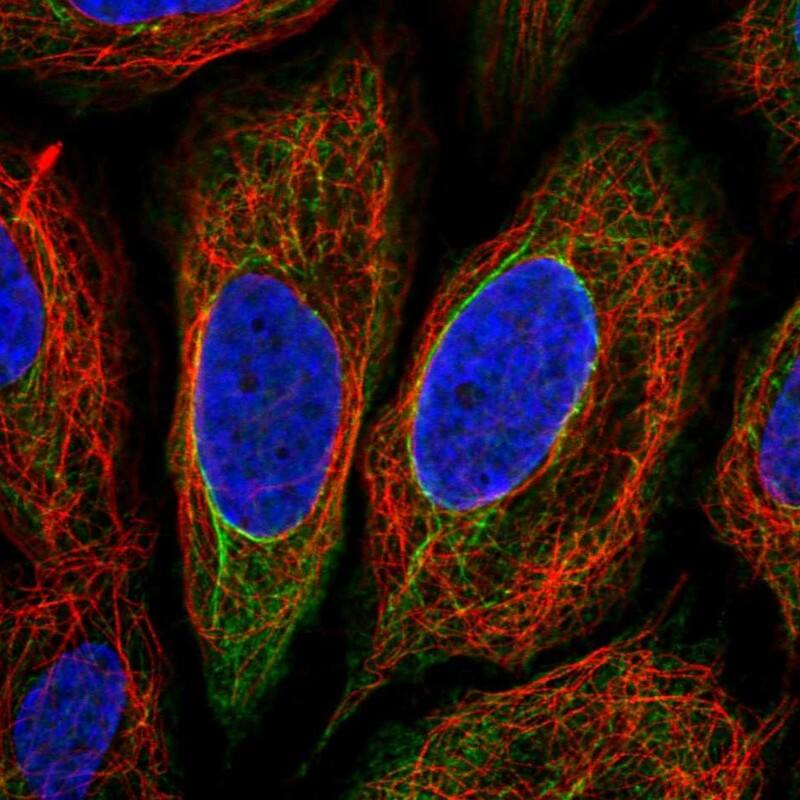 Staining of human cell line SiHa shows localization to intermediate filaments.