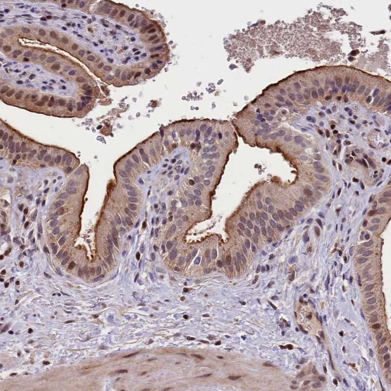 Staining of human gallbladder shows cytoplasmic and luminal positivity in glandular cells.
