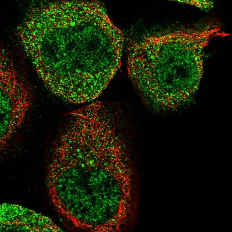 Staining of human cell line A-431 shows localization to nucleoplasm & cytosol.