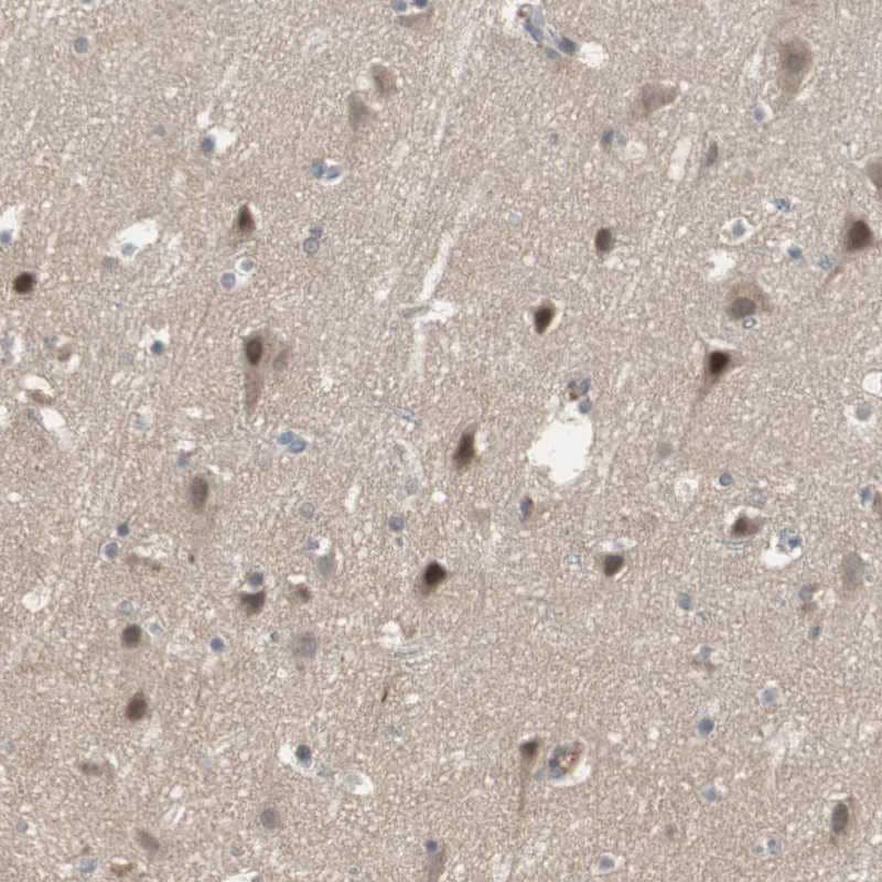Immunohistochemistry-Paraffin SNX4 Antibody - BSA Free