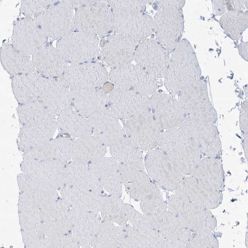 Immunohistochemistry-Paraffin ATP11C Antibody - BSA Free
