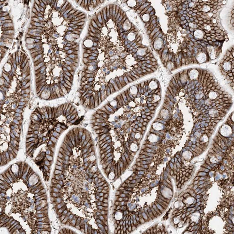 Immunohistochemistry-Paraffin ATP11C Antibody - BSA Free