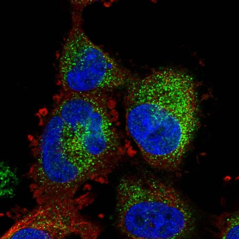 Staining of human cell line U-251 MG shows localization to vesicles.