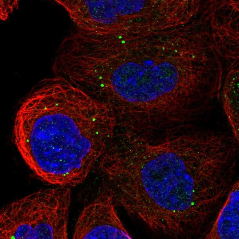 Staining of human cell line A-431 shows localization to vesicles.