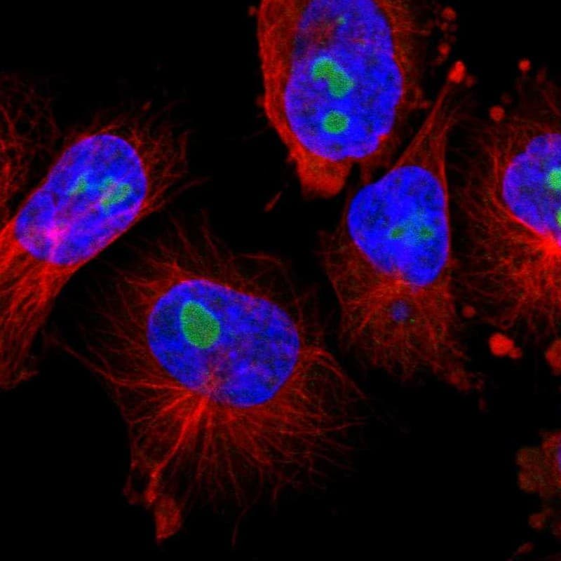 Staining of human cell line U-251 MG shows localization to nucleoli.