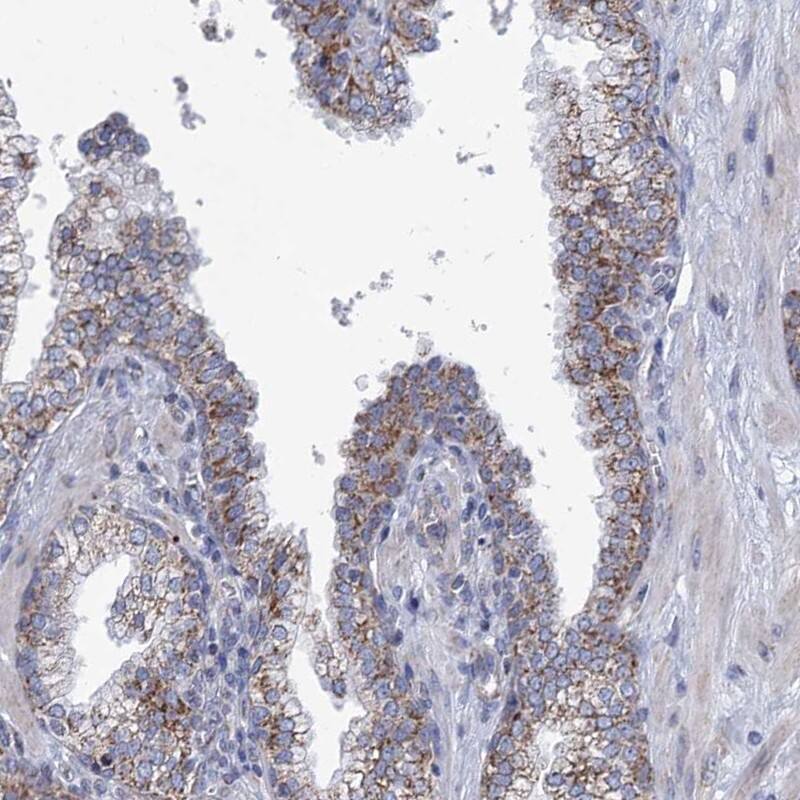 Staining of human prostate shows granular cytoplasmic  positivity in glandular cells.